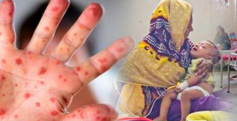 হামে দুই মাসে প্রাণ গেল ৪৮১ জনের
