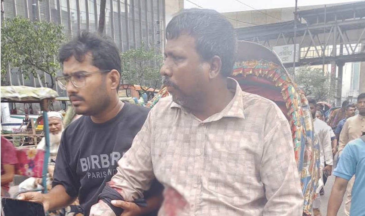 মতিঝিলে দিনদুপুরে ব্যবসায়ীকে গুলি করে ডলারসহ ব্যাগ ছিনতাই