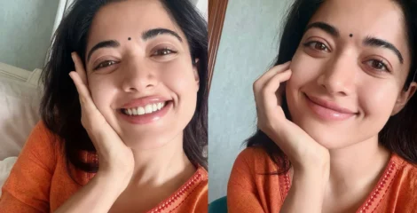 শুটিংয়ে গুরুতর চোট, ইনজুরি খুব বাজে জিনিস বললেন রাশমিকা