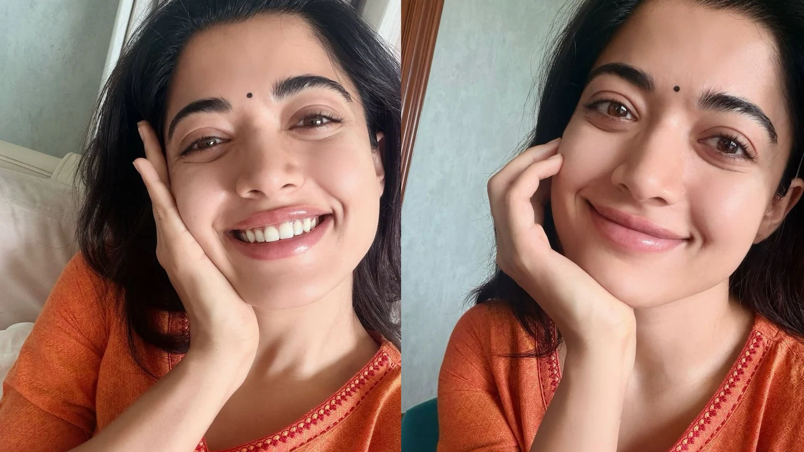 শুটিংয়ে গুরুতর চোট, ইনজুরি খুব বাজে জিনিস বললেন রাশমিকা
