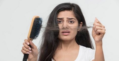 ডেঙ্গুর পর অতিরিক্ত চুল পড়ছে?